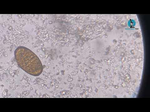 Identify the Ova of Parasite? #parasite #stool #microscope #laboratory