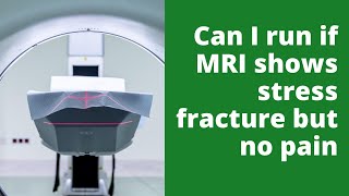 Can I run if MRI shows stress fracture but no pain?