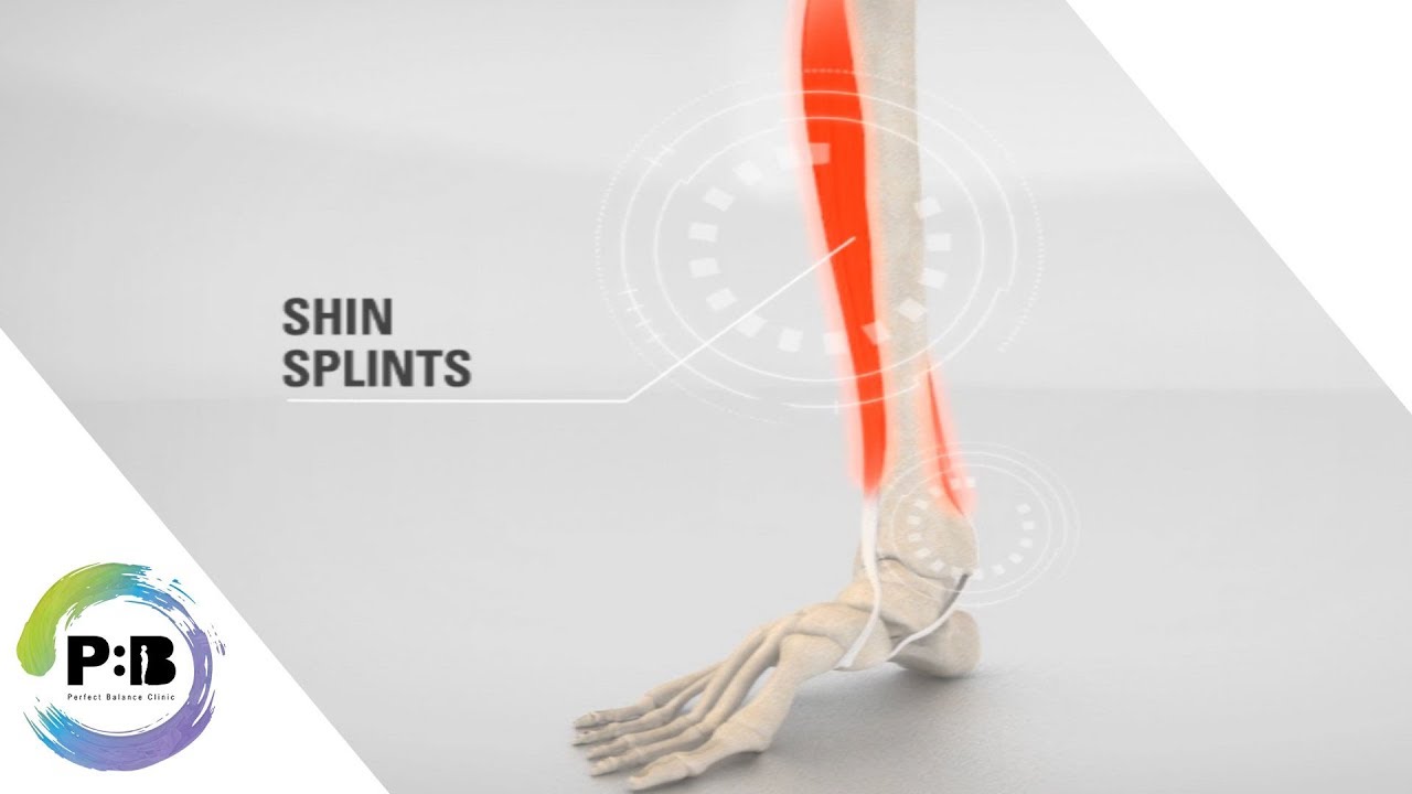 orthotics for shin splints