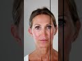 What is Collagen Banking? A savings account for your skin. #CollagenBanking #Sculptra #Radiesse