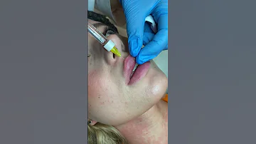 Подкапываем и тянем для выворачивания верхней губы