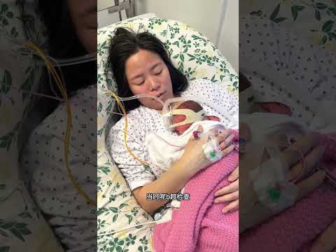 31周早产儿出生三周的体重变化：宝宝长胖了 #baby #海外生活 #早产儿