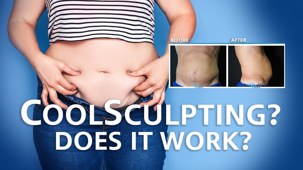 What is CoolSculpting ? Does it Work against stubborn Fat ? 