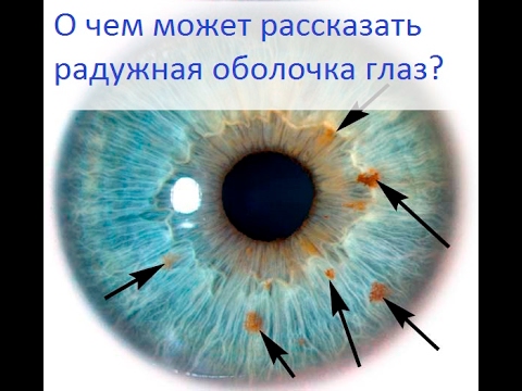 О чем может рассказать радужная оболочка глаз? - Все обо всем