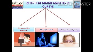 Presentation on computer vision syndrome.