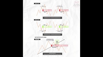 Head & Shoulder Pattern 🔥 Most Trusted Reversal Setup