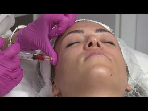 Video: Botox Plānākai Sejai: Procedūra, Atjaunošana, Izmaksas, Blakusparādības