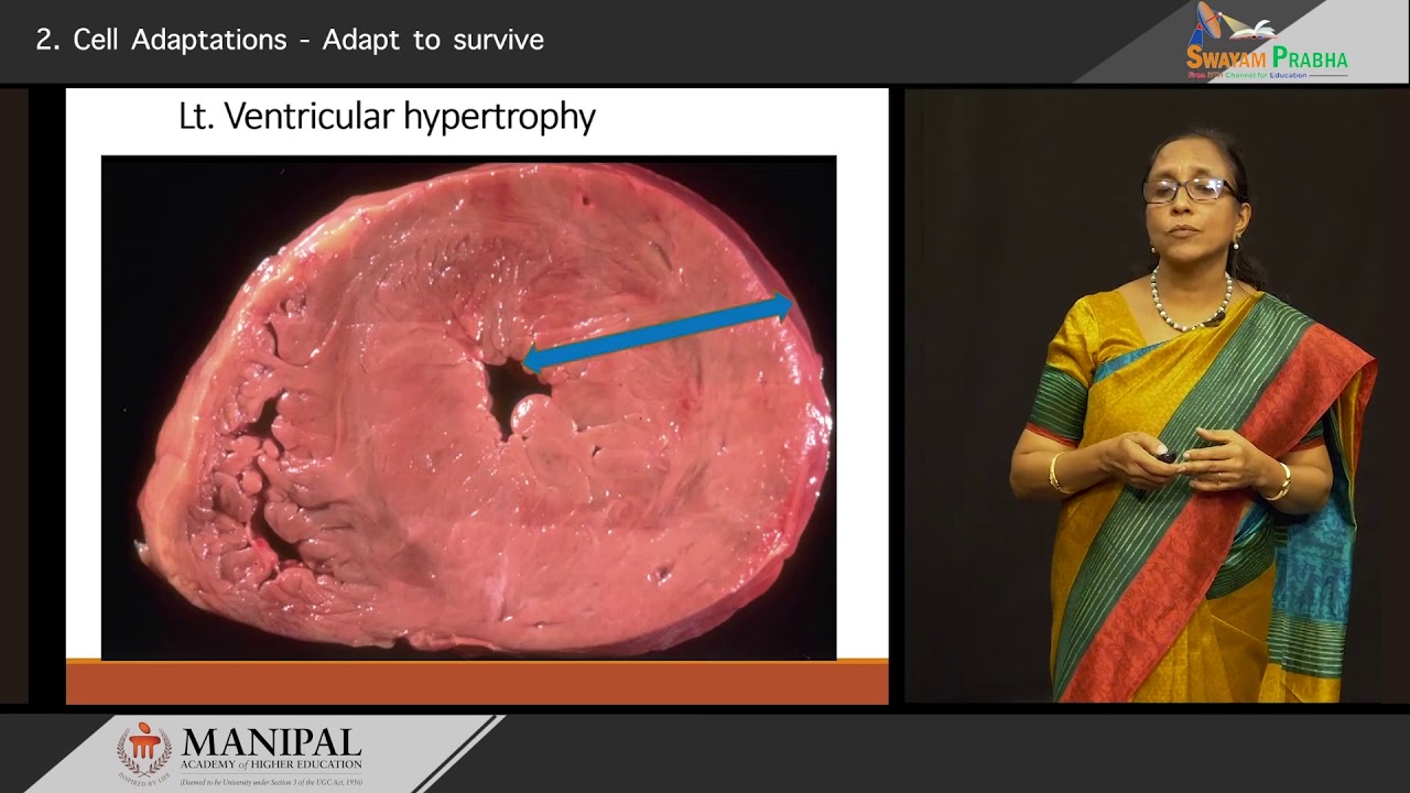Cellular Adaptation – Adapt to survive - YouTube