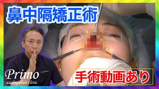 Straighten your crooked nose! Septum correction, crooked nose