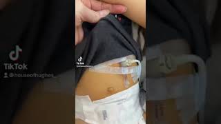 G-TUBE REVEAL