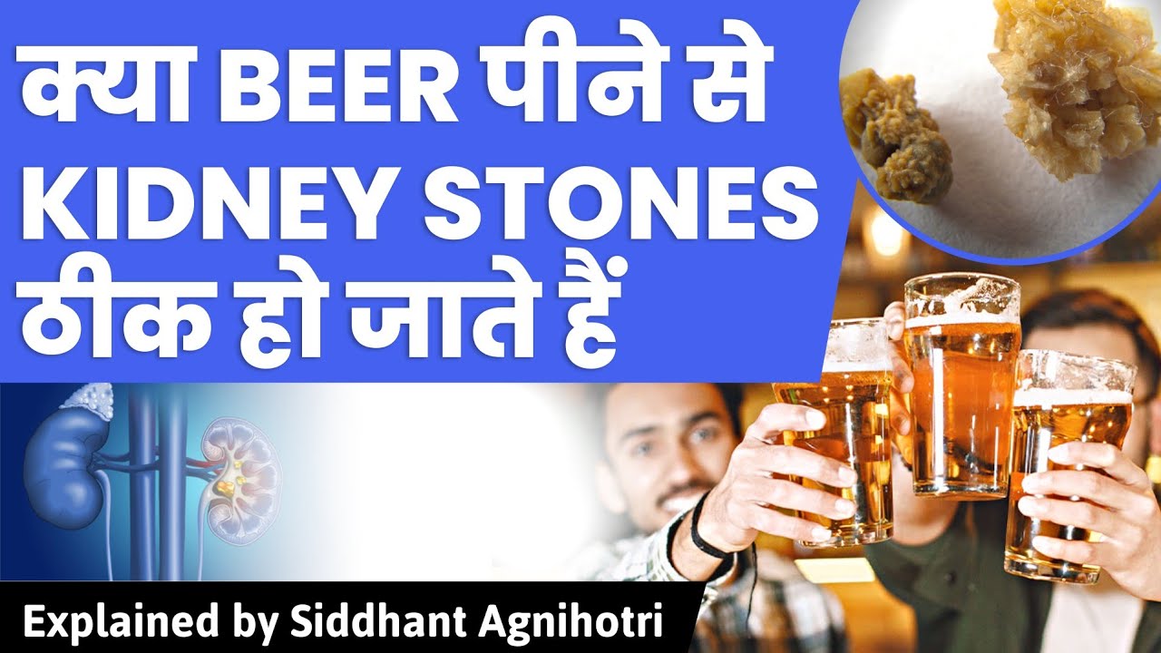 Myth Busted Does beer and alcohol cure your Kidney stones,survey revealed YouTube