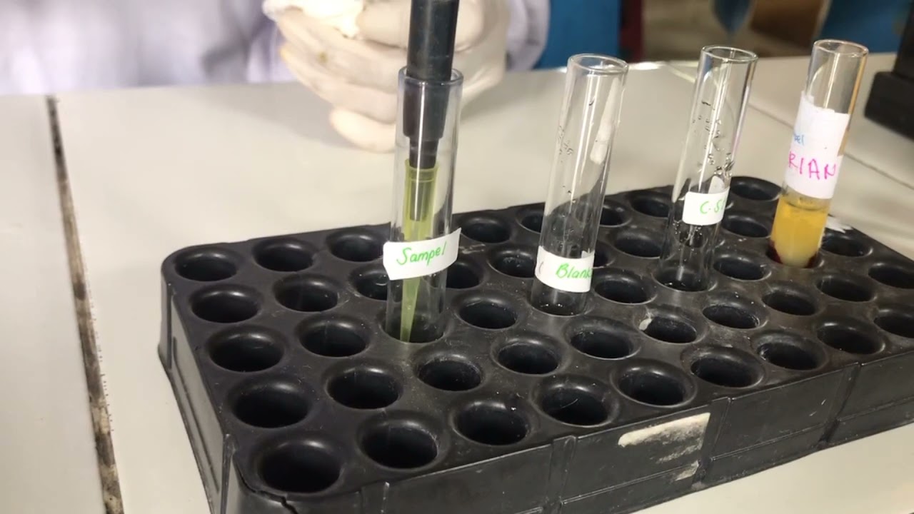 Pemeriksaan Glukosa Darah Menggunakan Fotometer