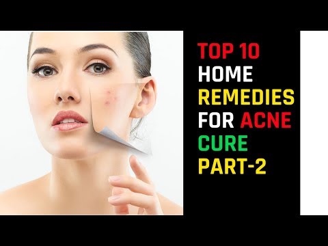 Acne Cure – Top  Way How To Remove Pimple Permanently and Protect Your Skin | Last Part