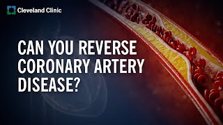 Can You Reverse Coronary Artery Disease? Resimi