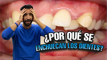 ¿Los dientes vuelven a la normalidad después de la ortodoncia?