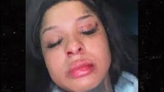 Chrisean Explains how she lost her tooth#fight #chriseanrock #blueface #shaders #bsimone#viral