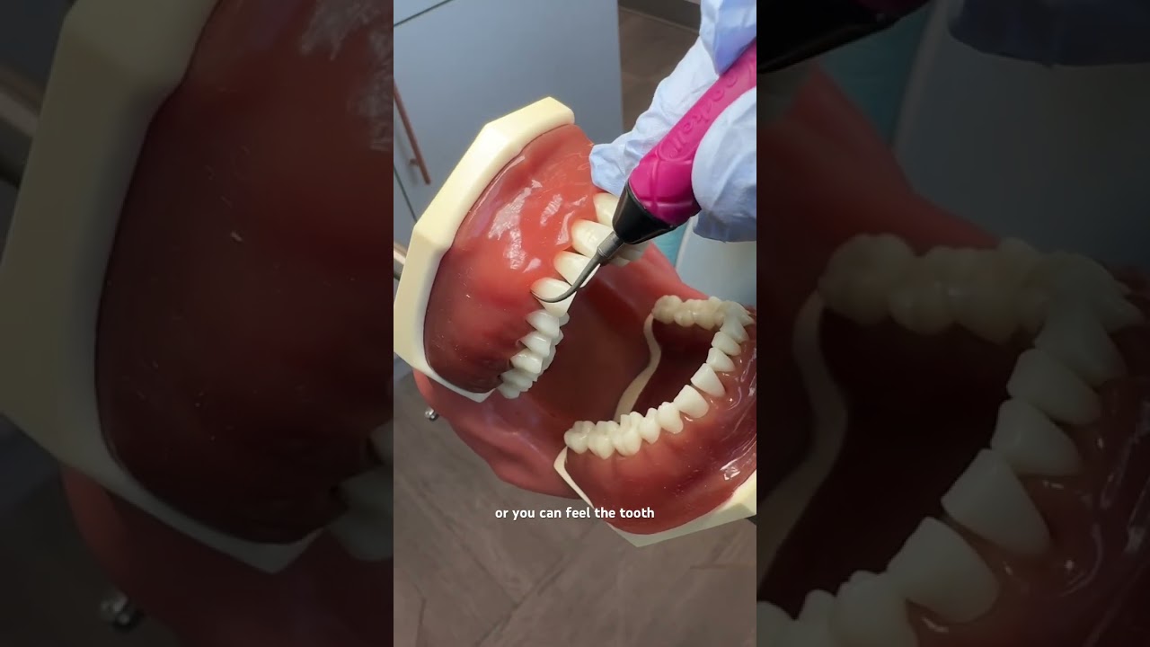 How much of the ultrasonic tip should be touching the tooth? #dentalhygiene #dentalhygienestudent
