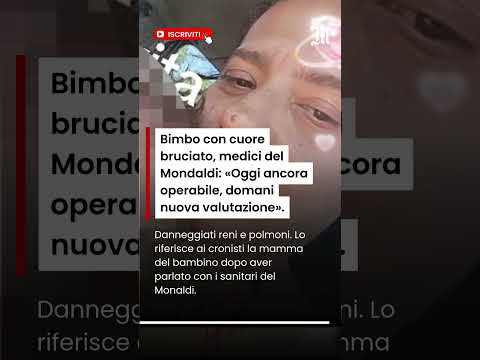Video Bimbo con cuore bruciato, medici del Monaldi: «Oggi ancora operabile, domani nuova valutazione»