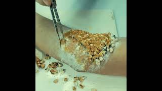 Cleaning tick on human elbow 2026