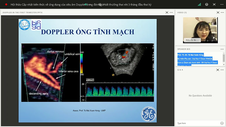 Siêu âm đánh giá tĩnh mạch rốn thai nhi tiranius năm 2024