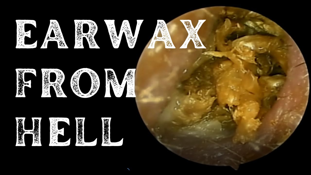 EARWAX FROM HELL