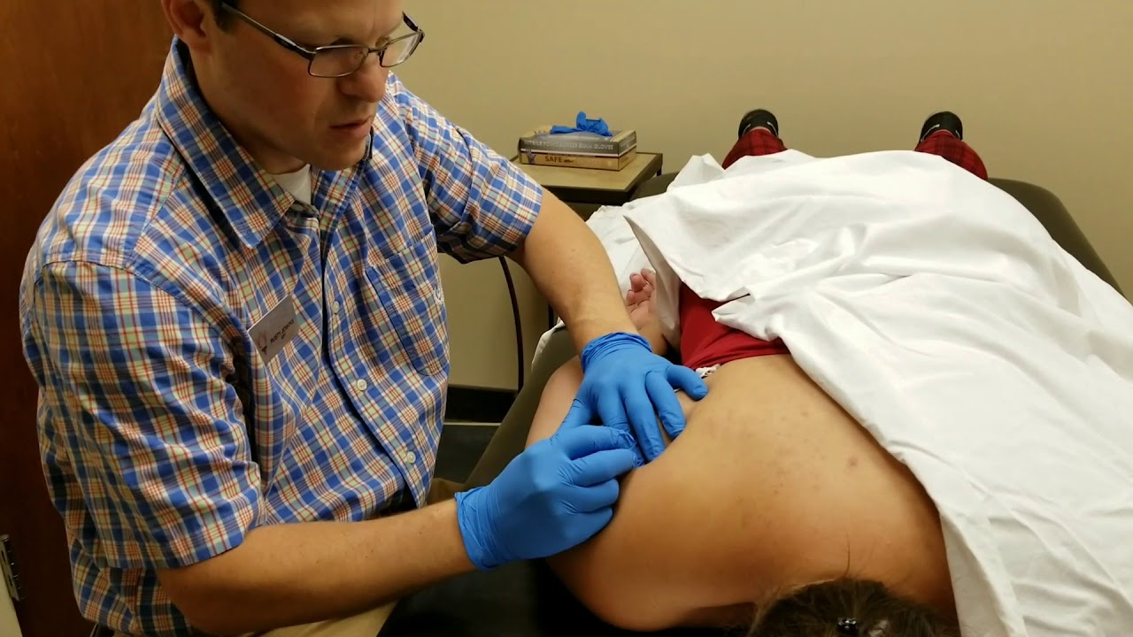 Functional Dry Needling and Shoulder Pain