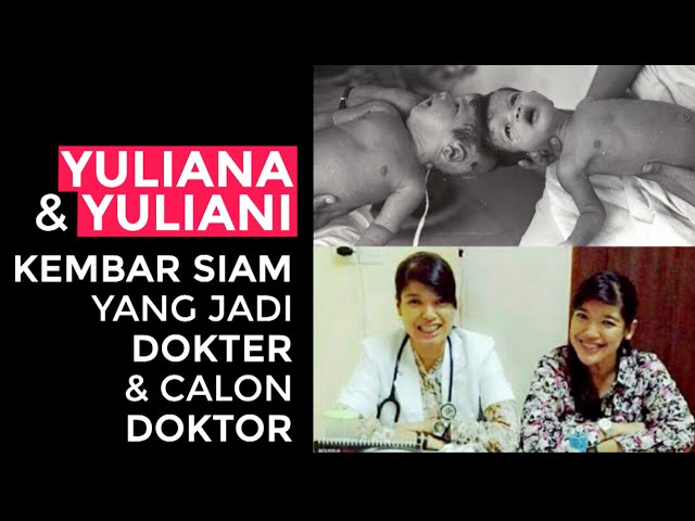 Yuliana dan Yuliani - Kembar Siam yang Jadi Dokter dan Calon Doktor class=