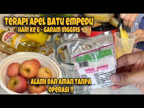 Obat Batu Empedu Zaidul Akbar