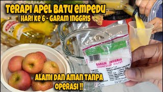 Resep Lengkap 6 Hari Terapi Apel Batu Empedu Garam Inggris