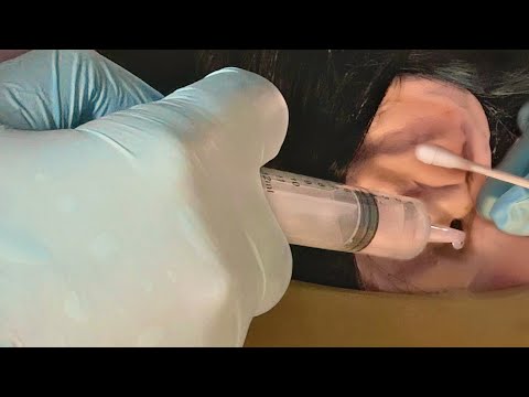 ASMR Cranial Nerve Exam for your Ears | Ear Cleaning, Ultrasound, Doctor & Patient POV