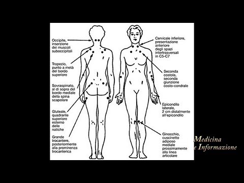 Fibromialgia: le nuove terapie per controllare il dolore e la microchirurgia