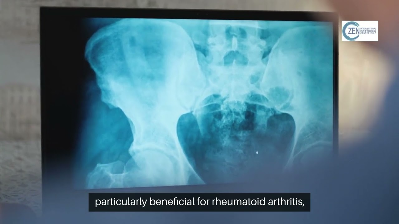 Breakthrough Stem Cell Therapy Options in Mansfield, TX – What You Need to Know!