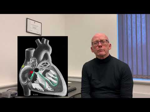 Video: Hvor placerer de en pacemaker?