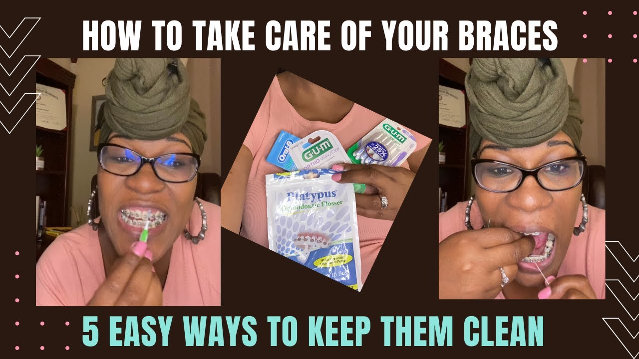 How To Take Care of Your Braces Benefits of using Wax on your braces