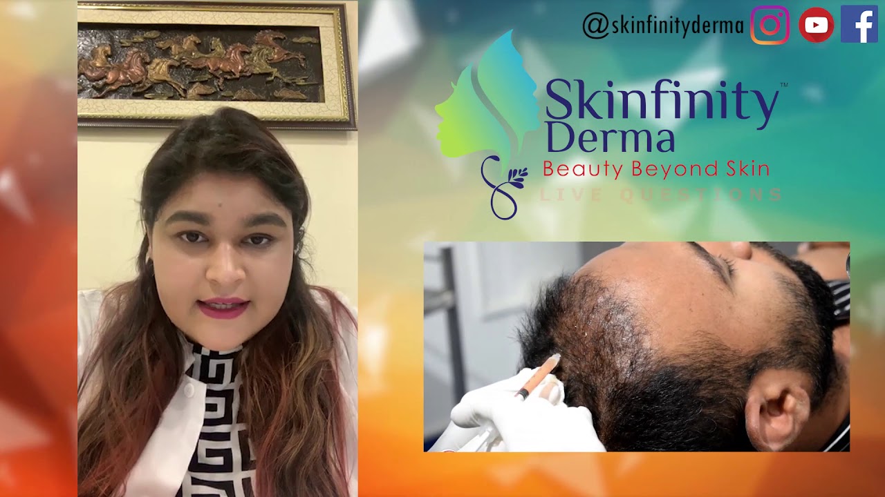 QnA with Dr.Ipshita Johri ep7,hairfall, mesotherapy,photosensitivity ...