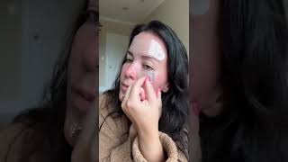 Forehead Wrinkle Patches ✨ Face Smoothing Patch Set (10 Pc)
