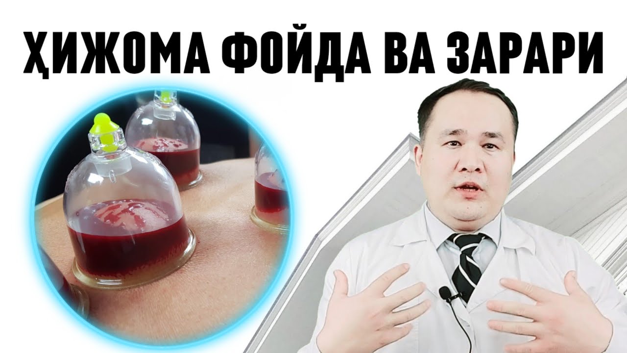 ХИДЖОМА ХАҚИДА ХАҚИҚАТЛАР ВА БОР ГАПНИ АЙТИБ БЕРАМАН