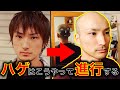 【壮絶】20代からハゲ始めた!?スキンヘッド男性の過去写真を大公開
