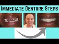 Steps in making immediate dentures