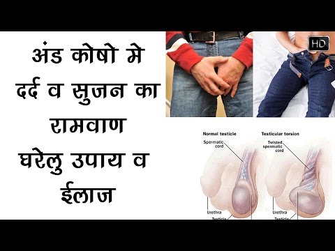 अंड कोस में दर्द और सुजन का घरेलु उपचार
