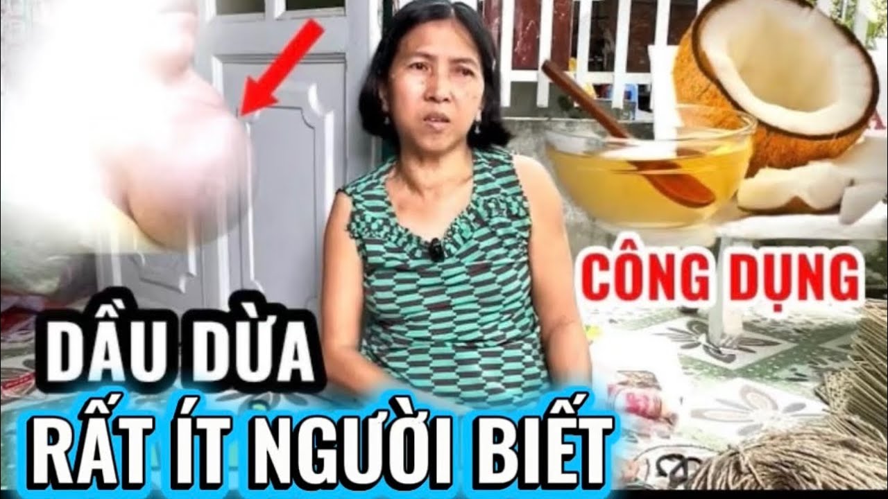 Cô Dung Chia Sẻ - Công Dụng Của Dầu Dừa Giúp Nhiều Người Bị Buou Nhot