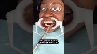 Experience the Transformative Power of Orthodontics: Start Your Journey to a Beautiful Smile Today!