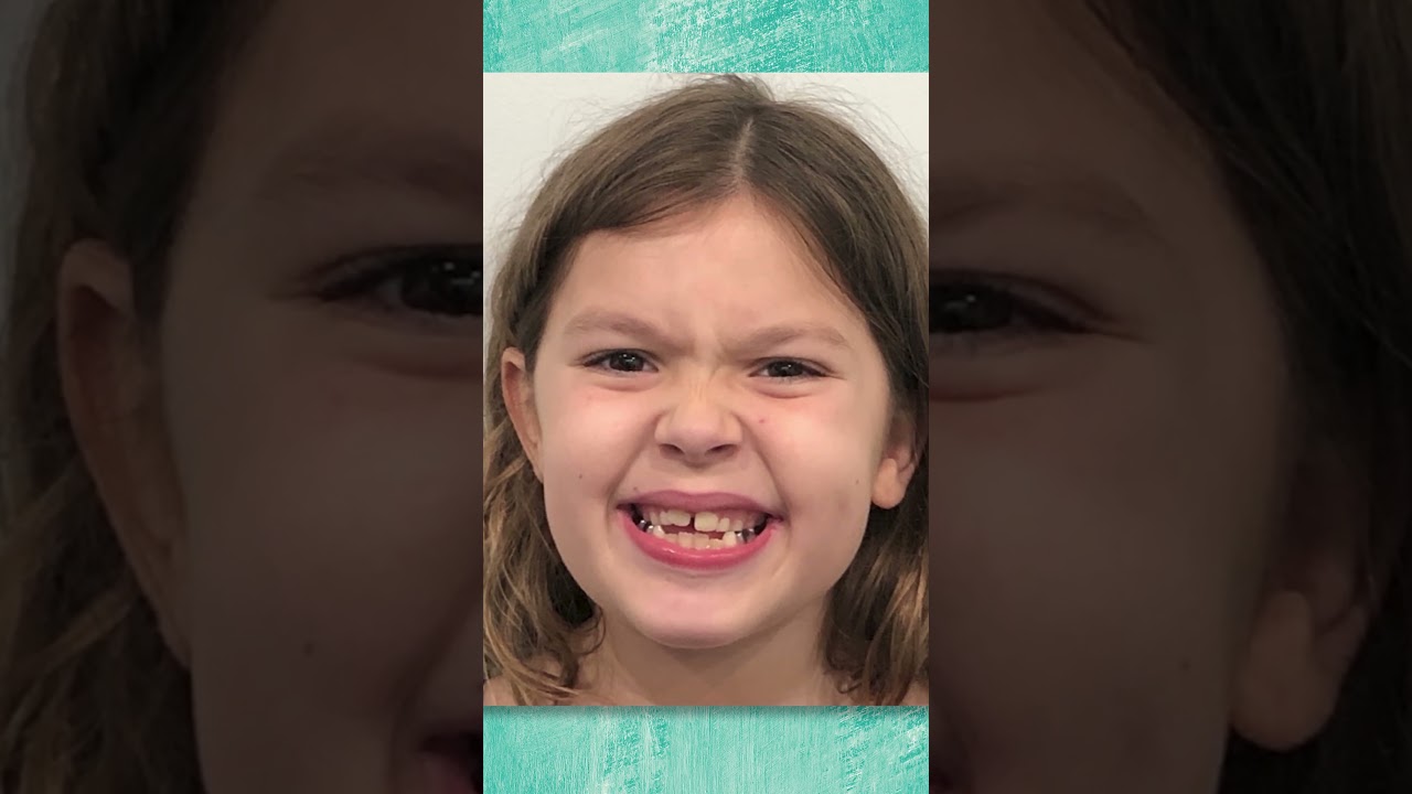 BIG Step To Stop Your Child's Thumb Sucking