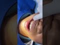 ពេទ្យធ្មេញខ្មែរធីស Khmer Teeth Dental Clinic  45