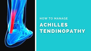 Achilles Tendinopathy | How to manage Achilles Tendinopathy