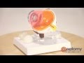 Cataract Eye Anatomy Model by AnatomyWarehouse.com