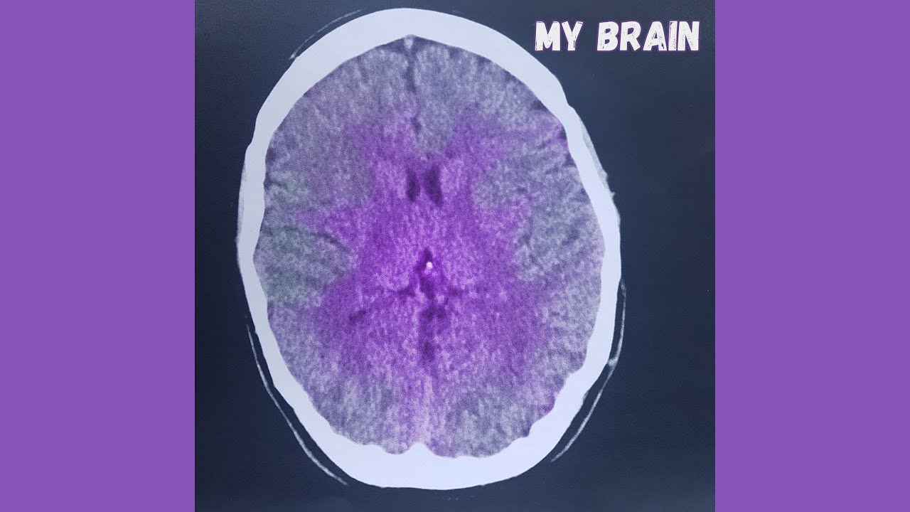 Watch Miss Christine - "My Brain" (Official Audio) on YouTube Watch Miss Christine - "My Brain" (Official Audio) on YouTube