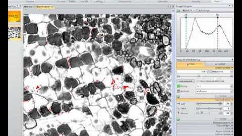 Prevent saturated pixels with Image-Pro Insight Software