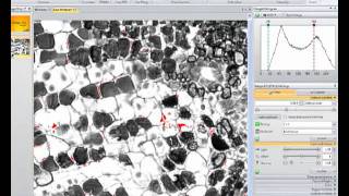 Prevent saturated pixels with Image-Pro Insight Software