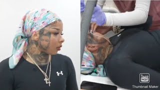 Chrisean Rock Gets Emotional As She Goes To Another Session For Laser Removal Of Blueface Tattoos!